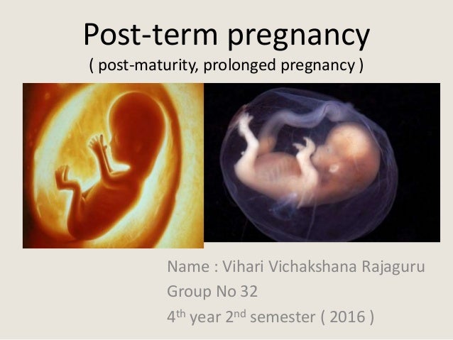 Postmatür Tıp Dilinde Nedir? 1 post term pregnancy 1 638