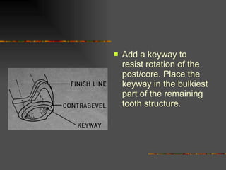Add a keyway to resist rotation of the post/core. Place the keyway in the bulkiest part of the remaining tooth structure.  