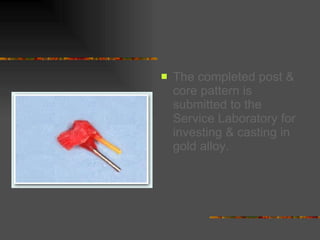 The completed post & core pattern is submitted to the Service Laboratory for investing & casting in gold alloy.   