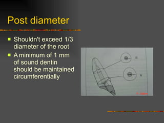 Post diameter Shouldn't exceed 1/3 diameter of the root A   minimum of 1 mm of sound dentin should be maintained circumferentially 