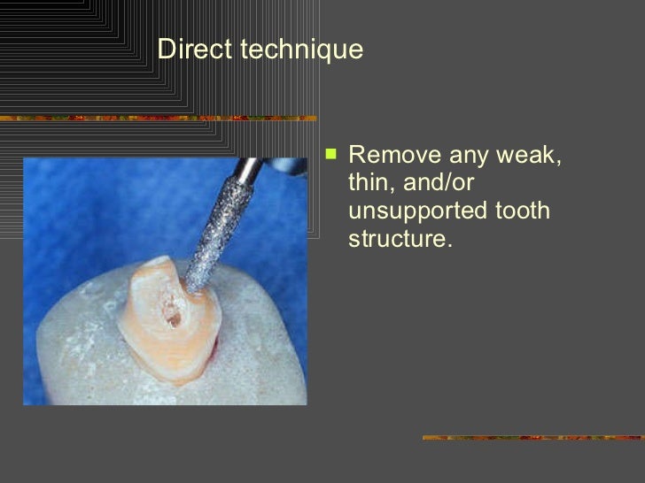 indirect technique