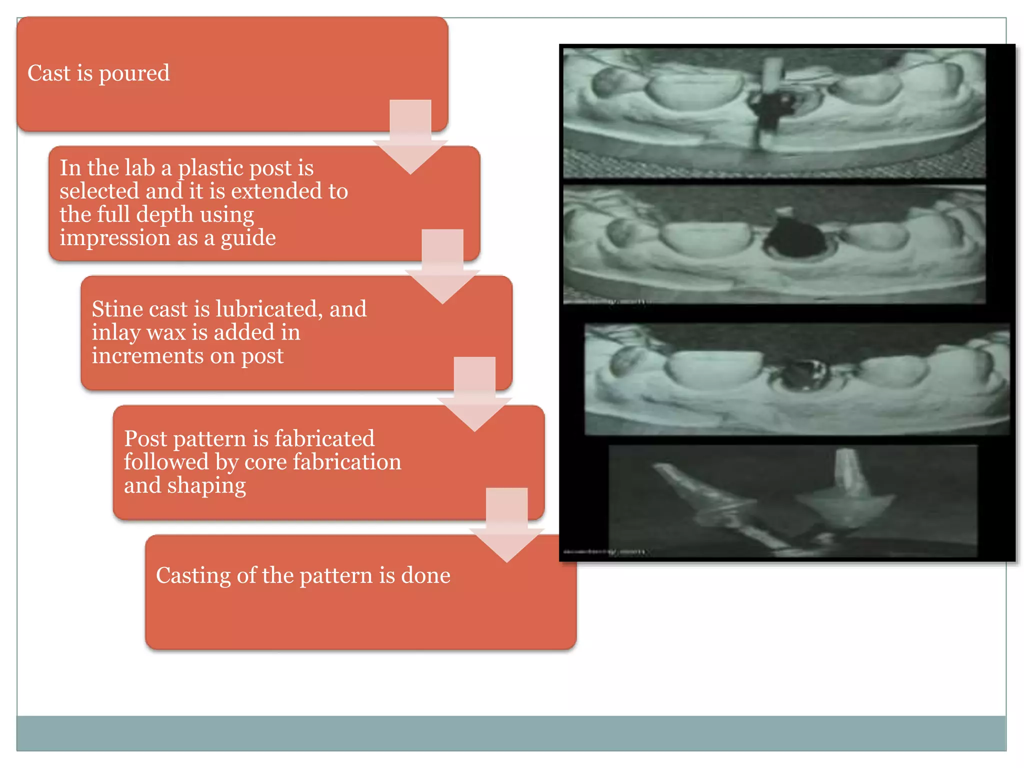 Cast is poured
In the lab a plastic post is
selected and it is extended to
the full depth using
impression as a guide
Stine cast is lubricated, and
inlay wax is added in
increments on post
Post pattern is fabricated
followed by core fabrication
and shaping
Casting of the pattern is done
 