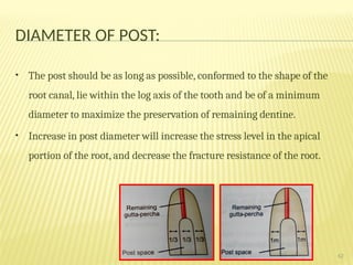 post and core implications in prosthodontics | PPTX