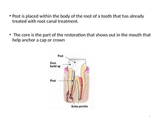 Post In Tooth Comprehensive Overview of Post and Core Dental Restoration Techniques ...