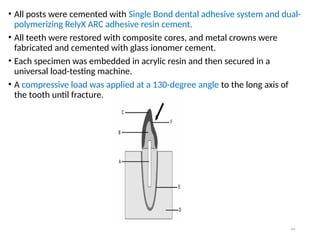Comprehensive Overview of Post and Core Dental Restoration Techniques ...