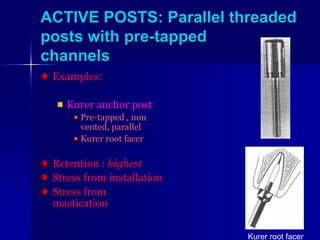 Pre Tapped Posts POST AND CORE (2).ppt