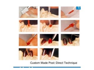 Post and core | PPTX
