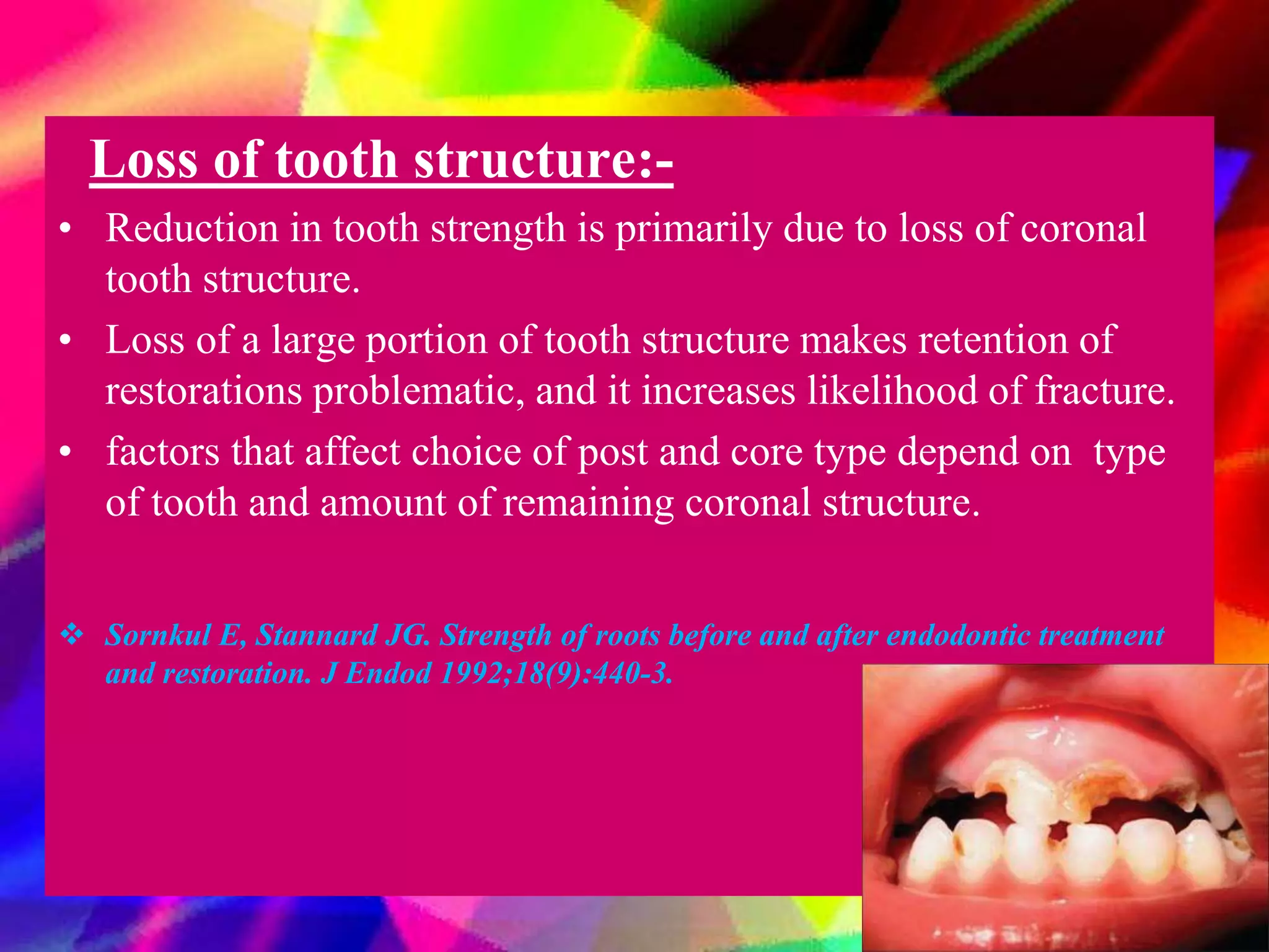 Post and core in primary teeth final to present | PPTX