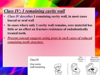 Tooth Case Classification Post and core in primary teeth final to present | PPTX