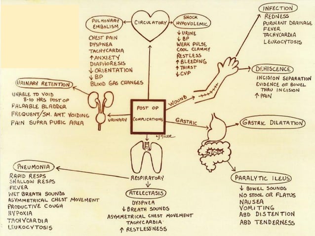 Last Algorithm Pacu Post anesthesia care unit(PACU) | PDF
