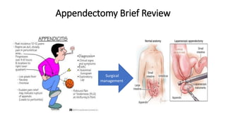 Appendectomy Brief Review
Surgical
management
 