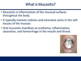What is Mucositis?
• Mucositis is inflammation of the mucosal surfaces
throughout the body
• It typically involves redness and ulcerative sores in the soft
tissues of the mucosa
• Oral mucositis manifests as erythema, inflammation,
ulceration, and hemorrhage in the mouth and throat.
 