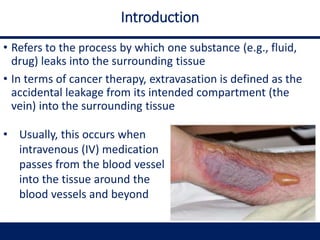 Introduction
• Refers to the process by which one substance (e.g., fluid,
drug) leaks into the surrounding tissue
• In terms of cancer therapy, extravasation is defined as the
accidental leakage from its intended compartment (the
vein) into the surrounding tissue
• Usually, this occurs when
intravenous (IV) medication
passes from the blood vessel
into the tissue around the
blood vessels and beyond
 
