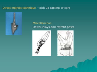 Post Indirect Kit POST & CORE.ppt