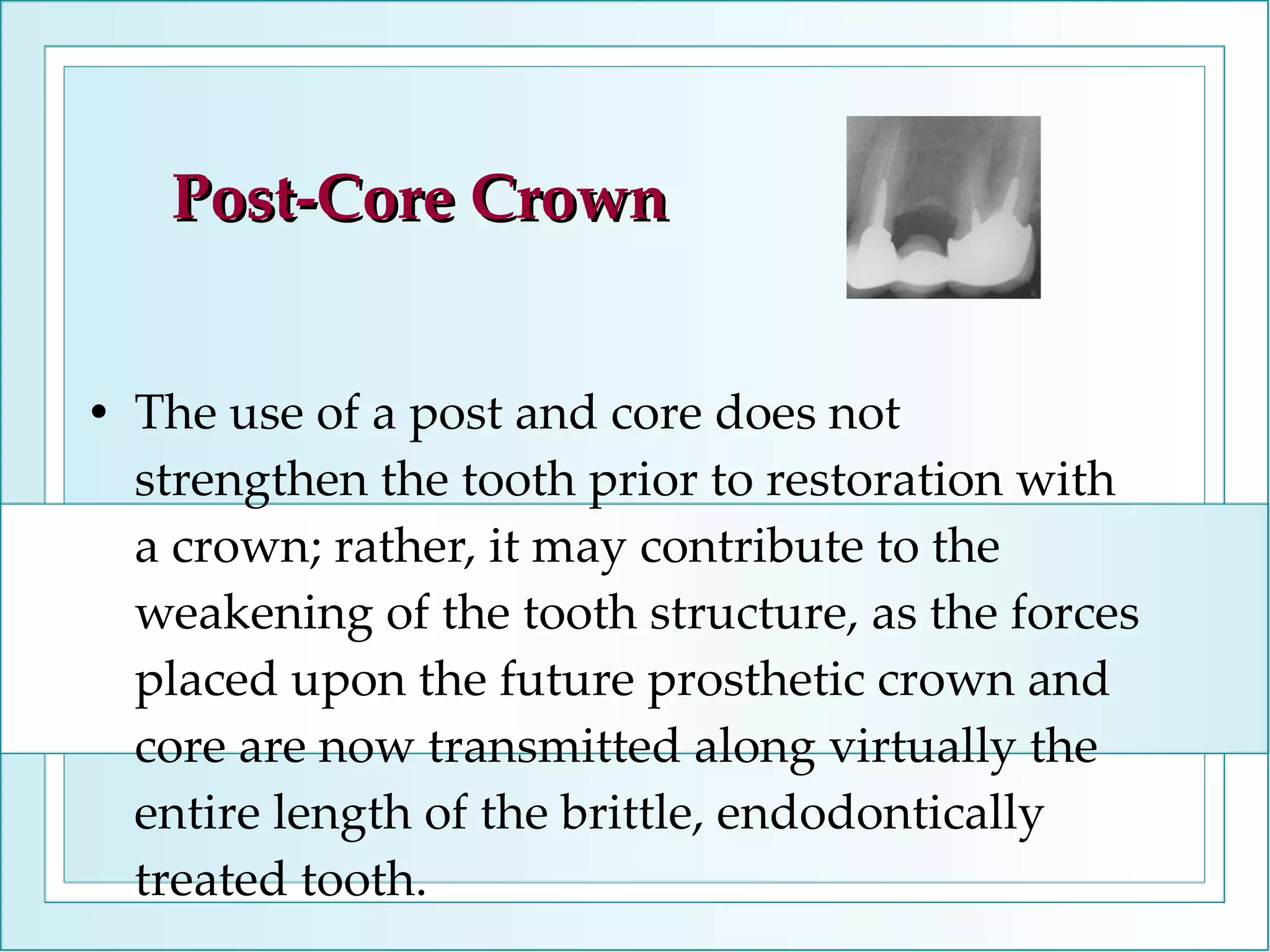 Post-Core Crown The use of a post and core does not strengthen the tooth prior to restoration with a crown; rather, it may contribute to the weakening of the tooth structure, as the forces placed upon the future prosthetic crown and core are now transmitted along virtually the entire length of the brittle, endodontically treated tooth.  