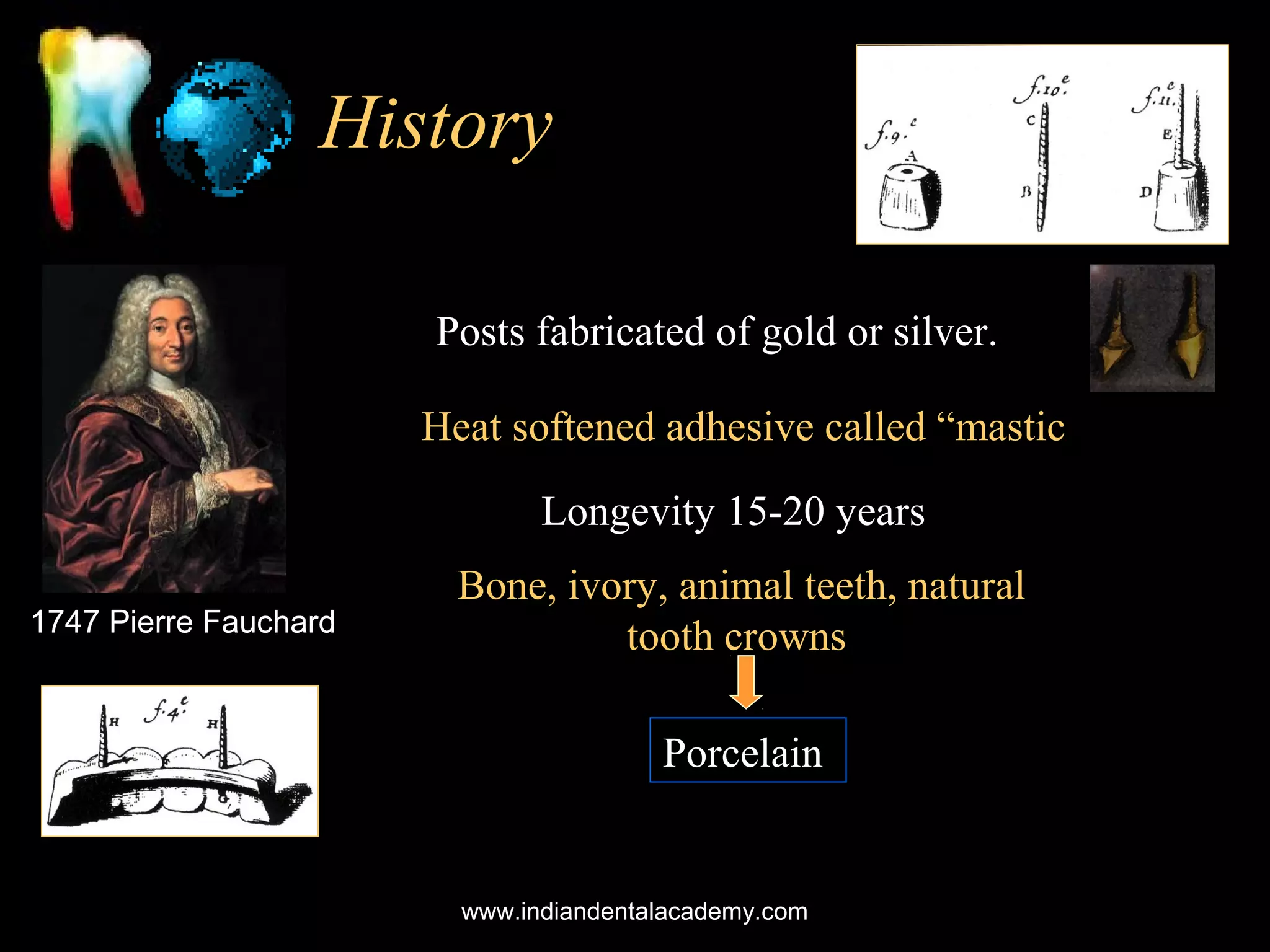 History
Posts fabricated of gold or silver.
Heat softened adhesive called “mastic
Longevity 15-20 years
1747 Pierre Fauchard

Bone, ivory, animal teeth, natural
tooth crowns
Porcelain

www.indiandentalacademy.com

 
