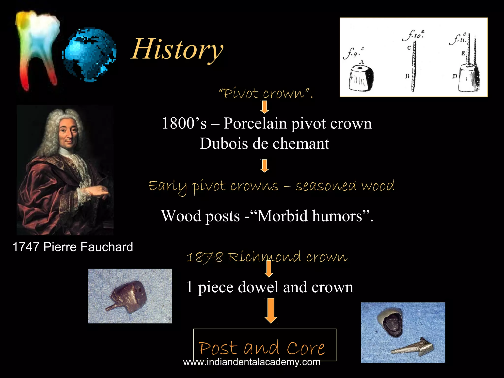 History
“Pivot crown”.
1800’s – Porcelain pivot crown
Dubois de chemant
Early pivot crowns – seasoned wood
Wood posts -“Morbid humors”.
1747 Pierre Fauchard

1878 Richmond crown
1 piece dowel and crown

Post and Core
www.indiandentalacademy.com

 