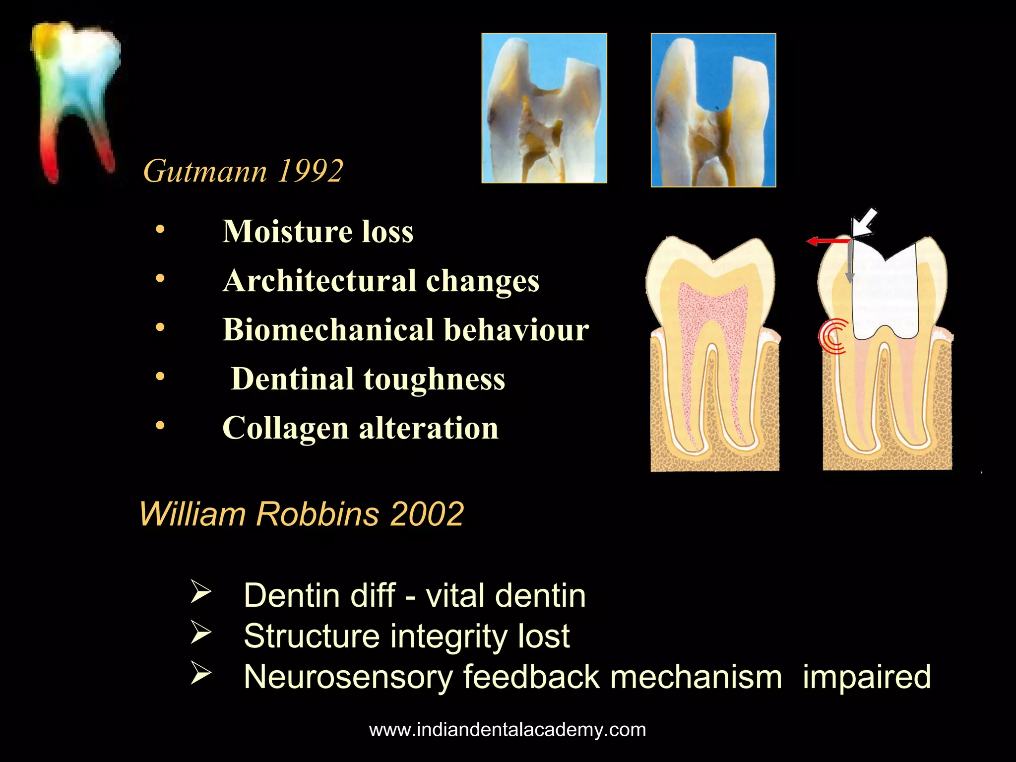 Gutmann 1992
•
•
•
•
•

Moisture loss
Architectural changes
Biomechanical behaviour
Dentinal toughness
Collagen alteration

William Robbins 2002
 Dentin diff - vital dentin
 Structure integrity lost
 Neurosensory feedback mechanism impaired
www.indiandentalacademy.com

 