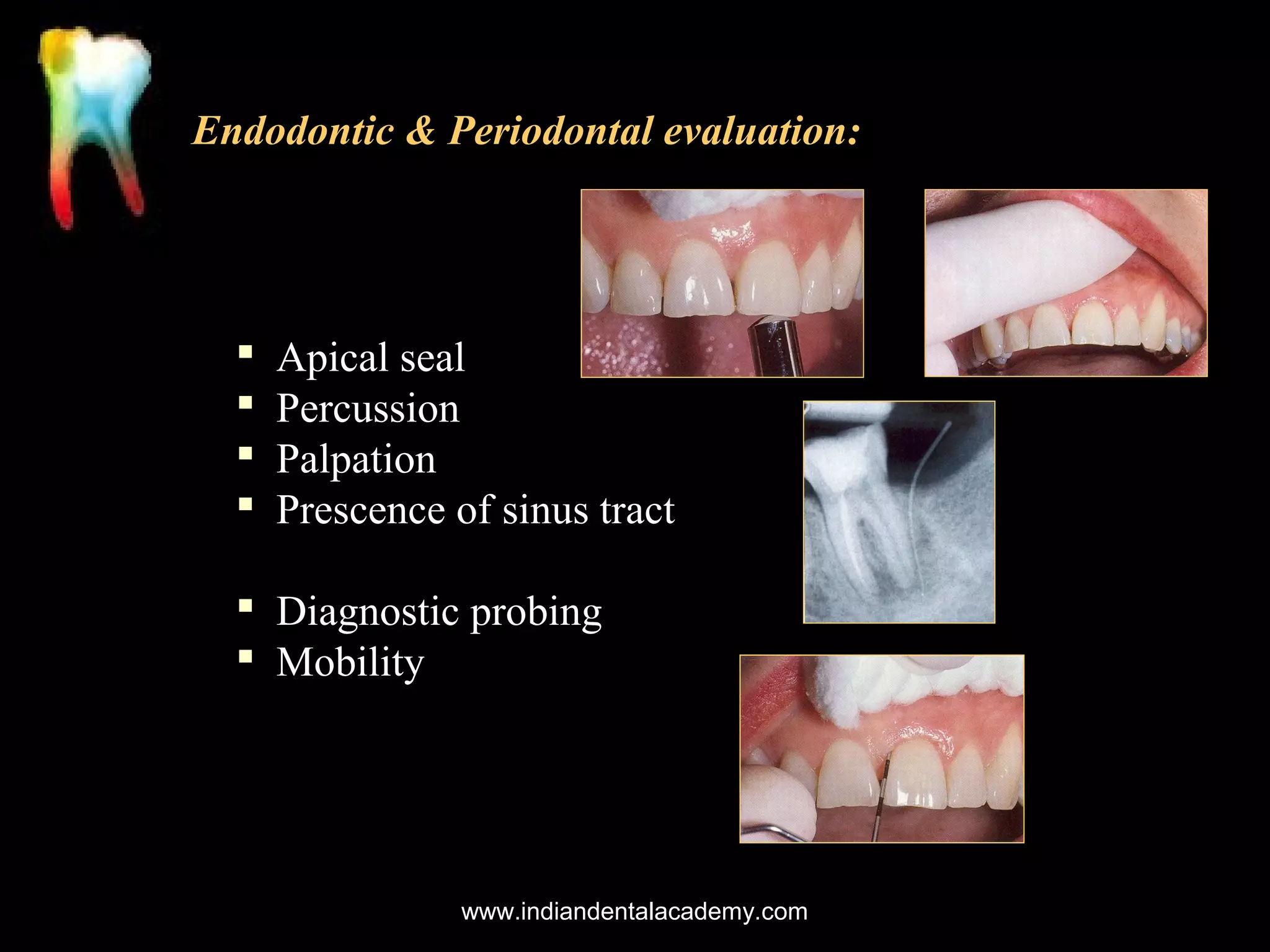 Endodontic & Periodontal evaluation:






Apical seal
Percussion
Palpation
Prescence of sinus tract

 Diagnostic probing
 Mobility

www.indiandentalacademy.com

 