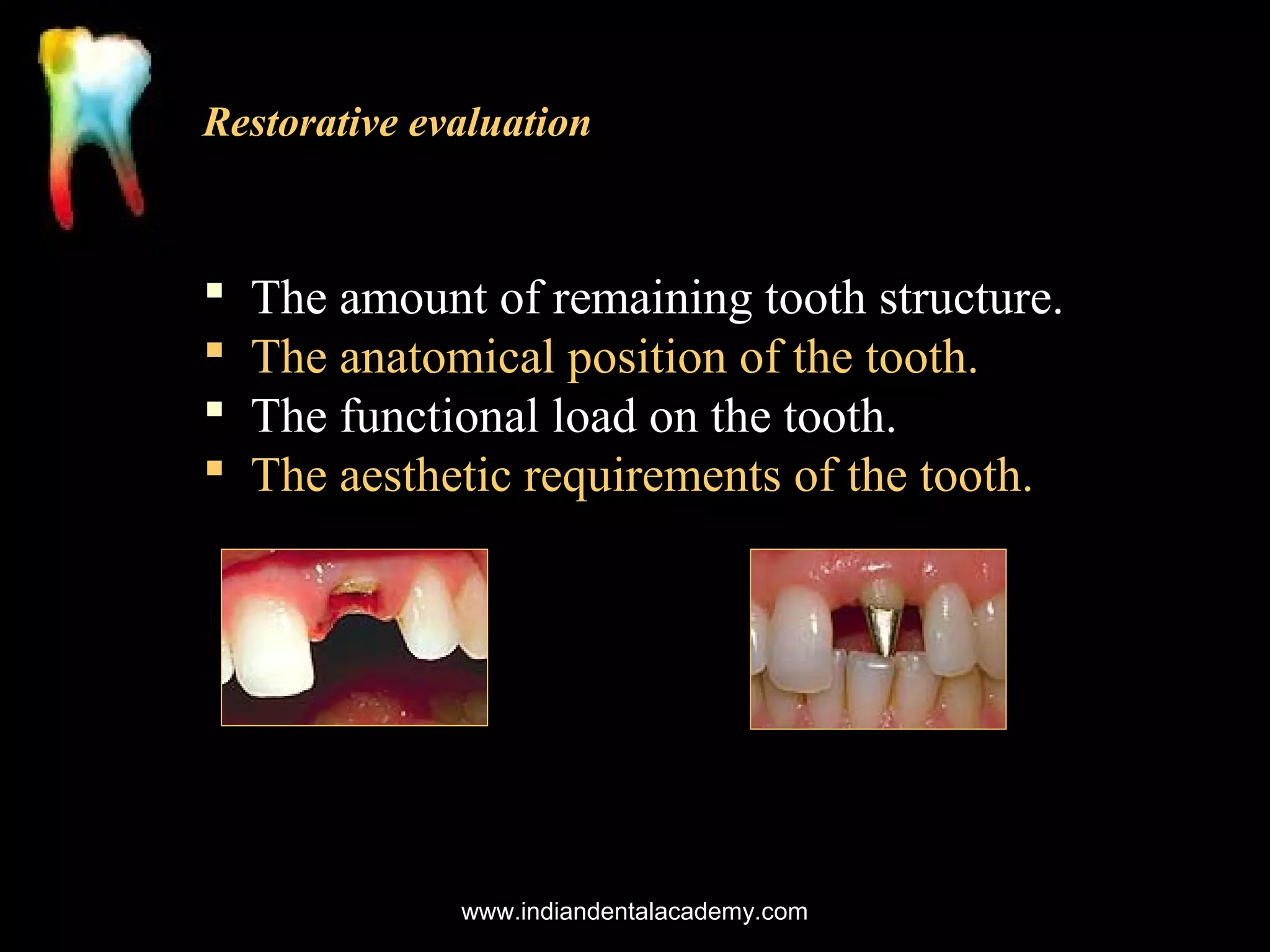 Restorative evaluation






The amount of remaining tooth structure.
The anatomical position of the tooth.
The functional load on the tooth.
The aesthetic requirements of the tooth.

www.indiandentalacademy.com

 