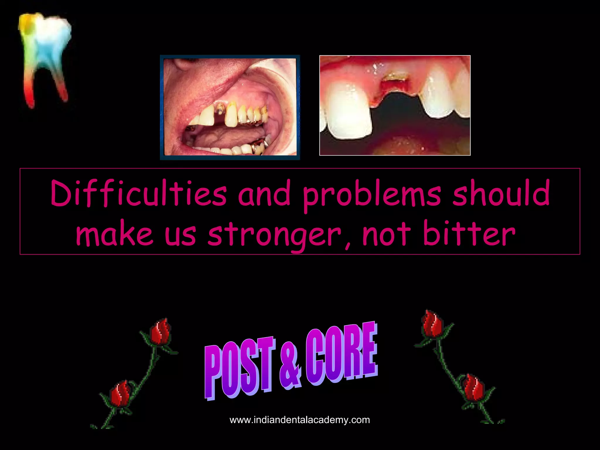 Difficulties and problems should
make us stronger, not bitter

www.indiandentalacademy.com

 