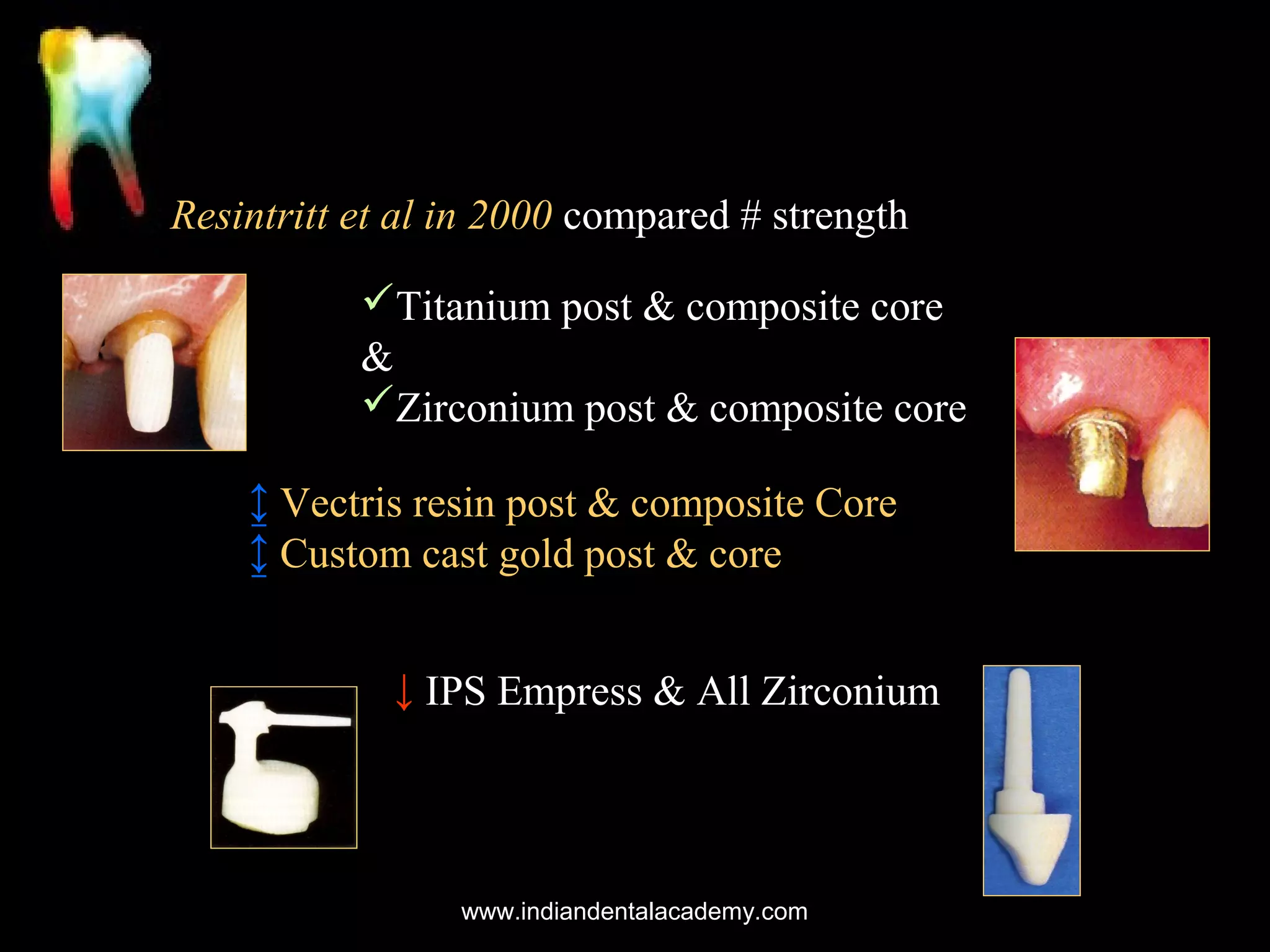 Resintritt et al in 2000 compared # strength
Titanium post & composite core
&
Zirconium post & composite core
↨ Vectris resin post & composite Core
↨ Custom cast gold post & core
↓ IPS Empress & All Zirconium

www.indiandentalacademy.com

 