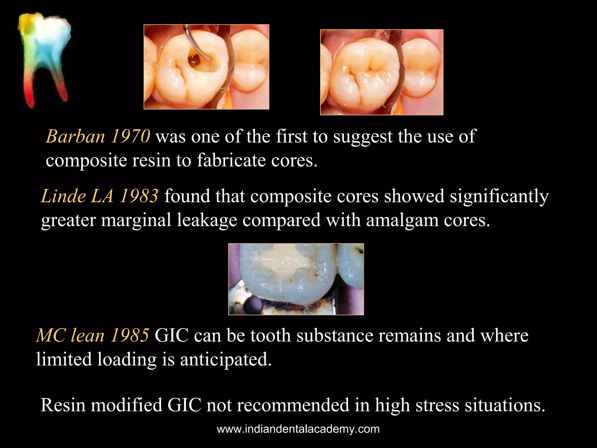 Barban 1970 was one of the first to suggest the use of
composite resin to fabricate cores.
Linde LA 1983 found that composite cores showed significantly
greater marginal leakage compared with amalgam cores.

MC lean 1985 GIC can be tooth substance remains and where
limited loading is anticipated.
Resin modified GIC not recommended in high stress situations.
www.indiandentalacademy.com

 