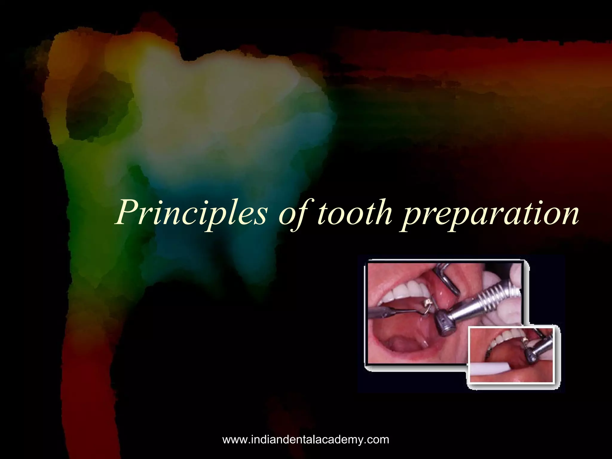 Principles of tooth preparation

www.indiandentalacademy.com

 