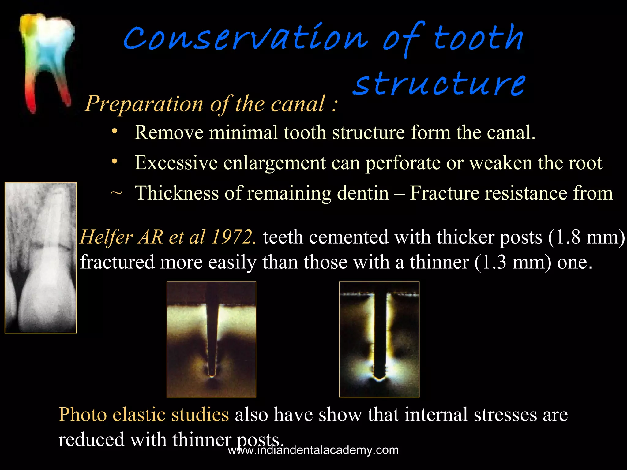 Conservation of tooth
structure
Preparation of the canal :
• Remove minimal tooth structure form the canal.
• Excessive enlargement can perforate or weaken the root
~ Thickness of remaining dentin – Fracture resistance from
Helfer AR et al 1972. teeth cemented with thicker posts (1.8 mm)
fractured more easily than those with a thinner (1.3 mm) one.

Photo elastic studies also have show that internal stresses are
reduced with thinnerwww.indiandentalacademy.com
posts.

 