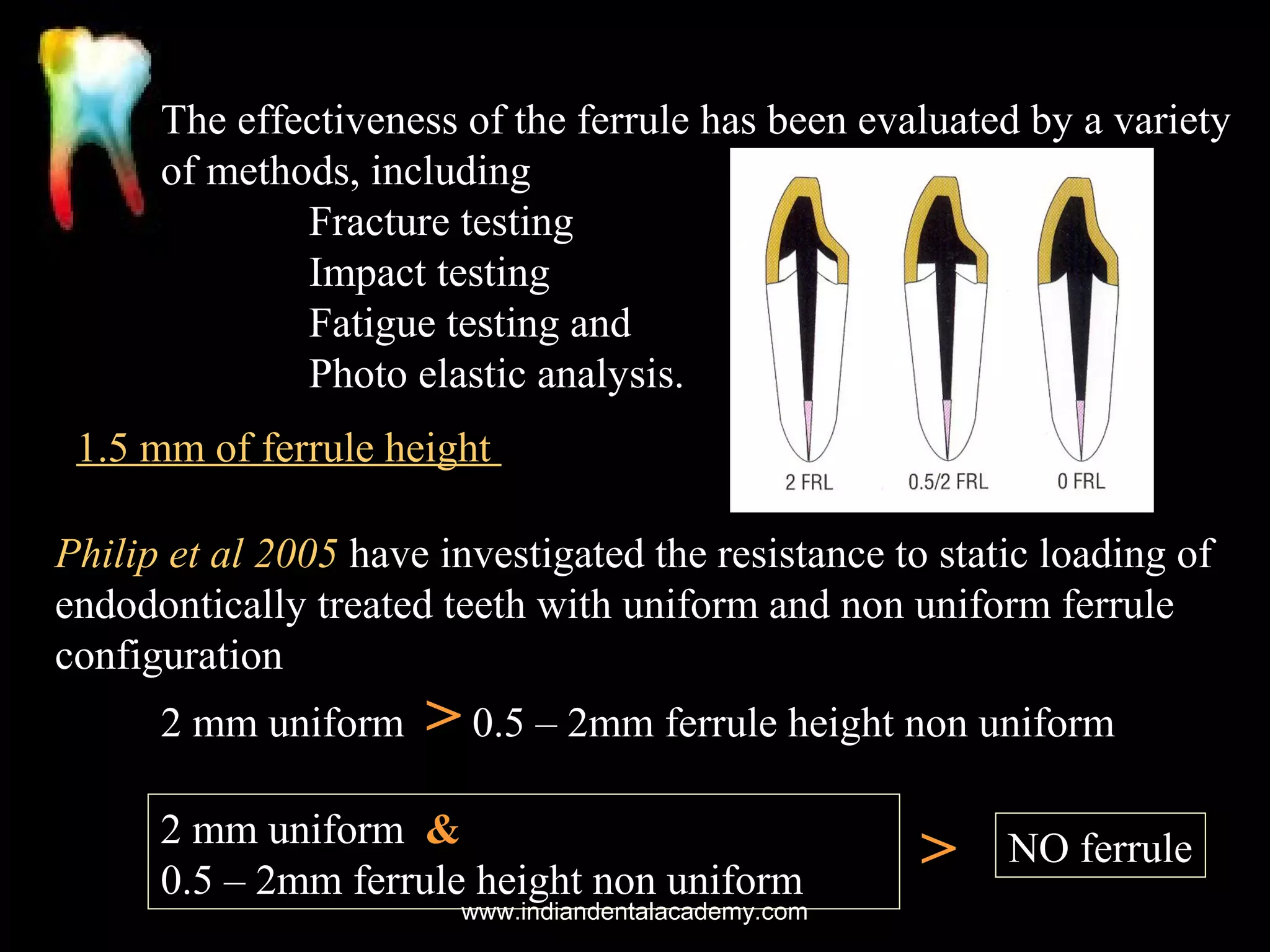 The effectiveness of the ferrule has been evaluated by a variety
of methods, including
Fracture testing
Impact testing
Fatigue testing and
Photo elastic analysis.
1.5 mm of ferrule height
Philip et al 2005 have investigated the resistance to static loading of
endodontically treated teeth with uniform and non uniform ferrule
configuration
2 mm uniform

> 0.5 – 2mm ferrule height non uniform

2 mm uniform &
0.5 – 2mm ferrule height non uniform

www.indiandentalacademy.com

>

NO ferrule

 