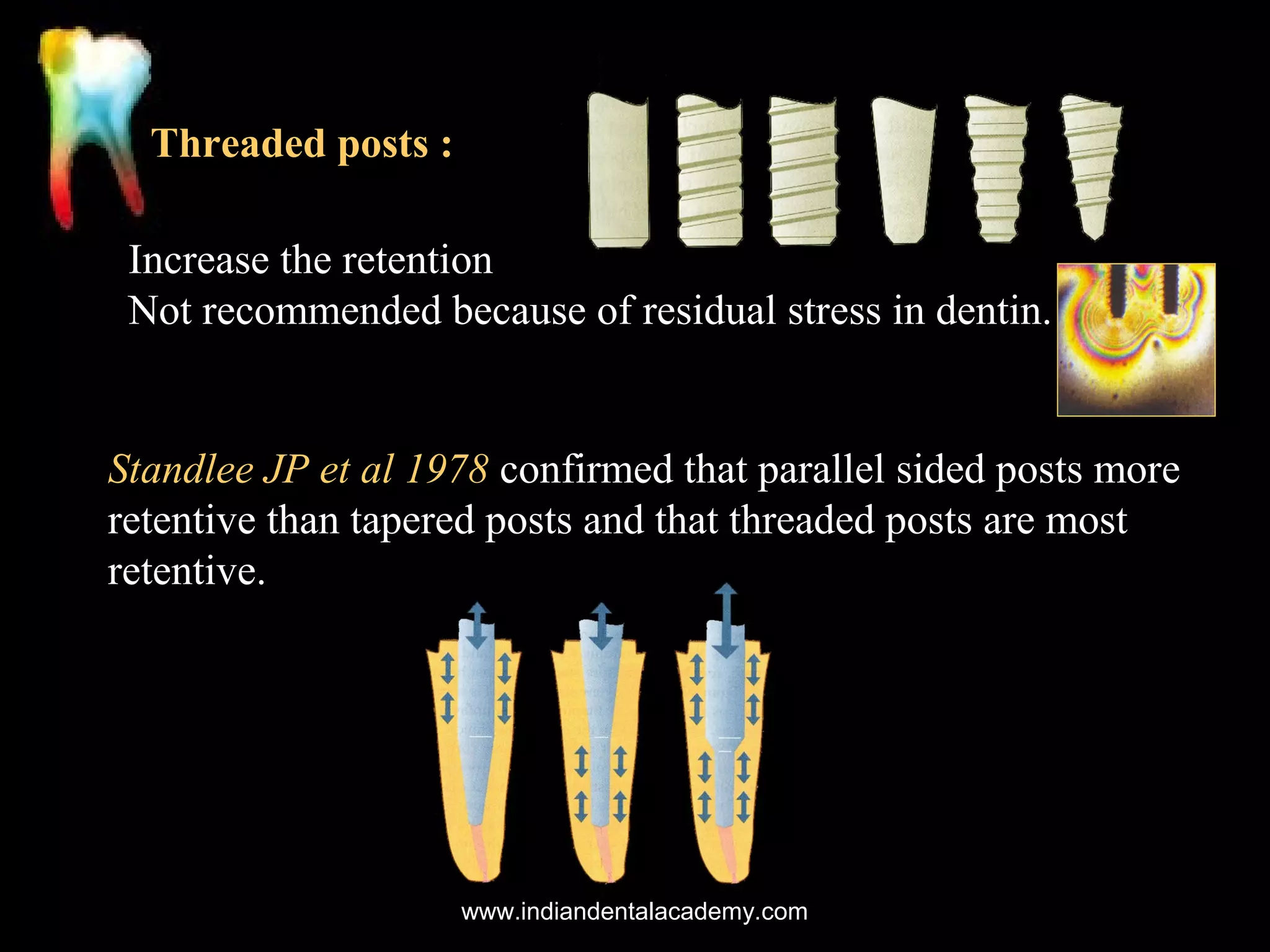 Threaded posts :
Increase the retention
Not recommended because of residual stress in dentin.

Standlee JP et al 1978 confirmed that parallel sided posts more
retentive than tapered posts and that threaded posts are most
retentive.

www.indiandentalacademy.com

 