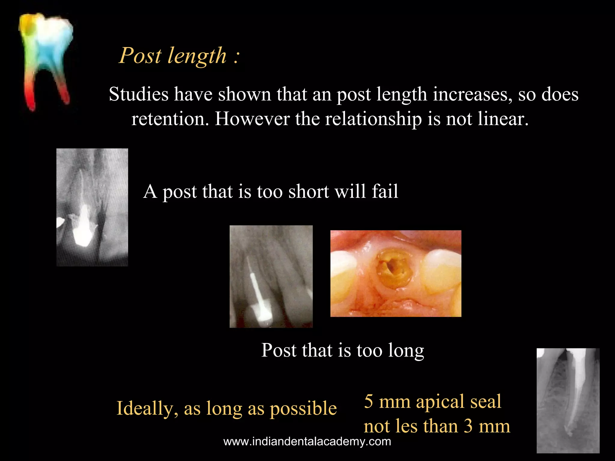 Post length :
Studies have shown that an post length increases, so does
retention. However the relationship is not linear.
A post that is too short will fail

Post that is too long
Ideally, as long as possible

5 mm apical seal
not les than 3 mm

www.indiandentalacademy.com

 