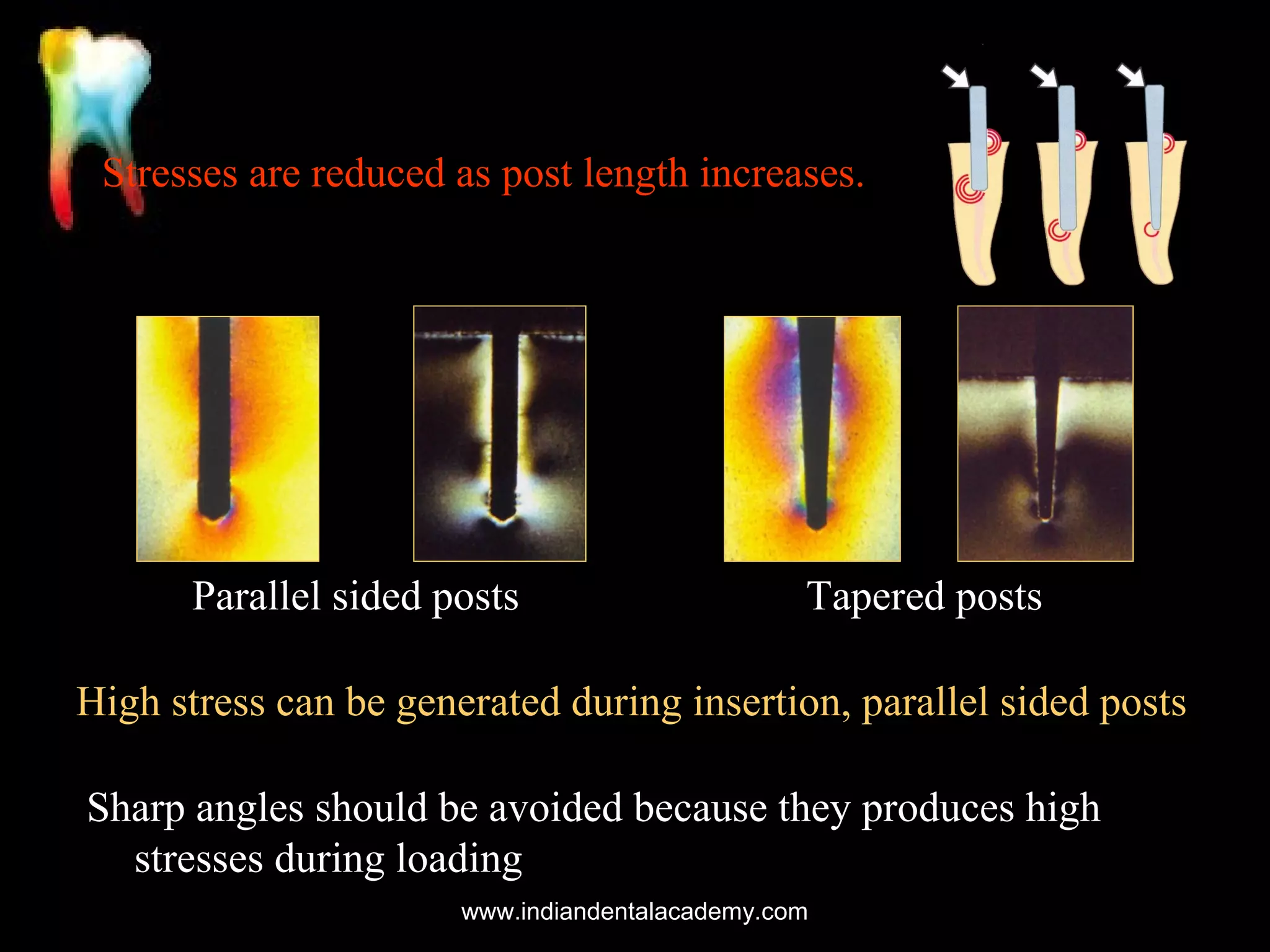 Stresses are reduced as post length increases.

Parallel sided posts

Tapered posts

High stress can be generated during insertion, parallel sided posts
Sharp angles should be avoided because they produces high
stresses during loading
www.indiandentalacademy.com

 