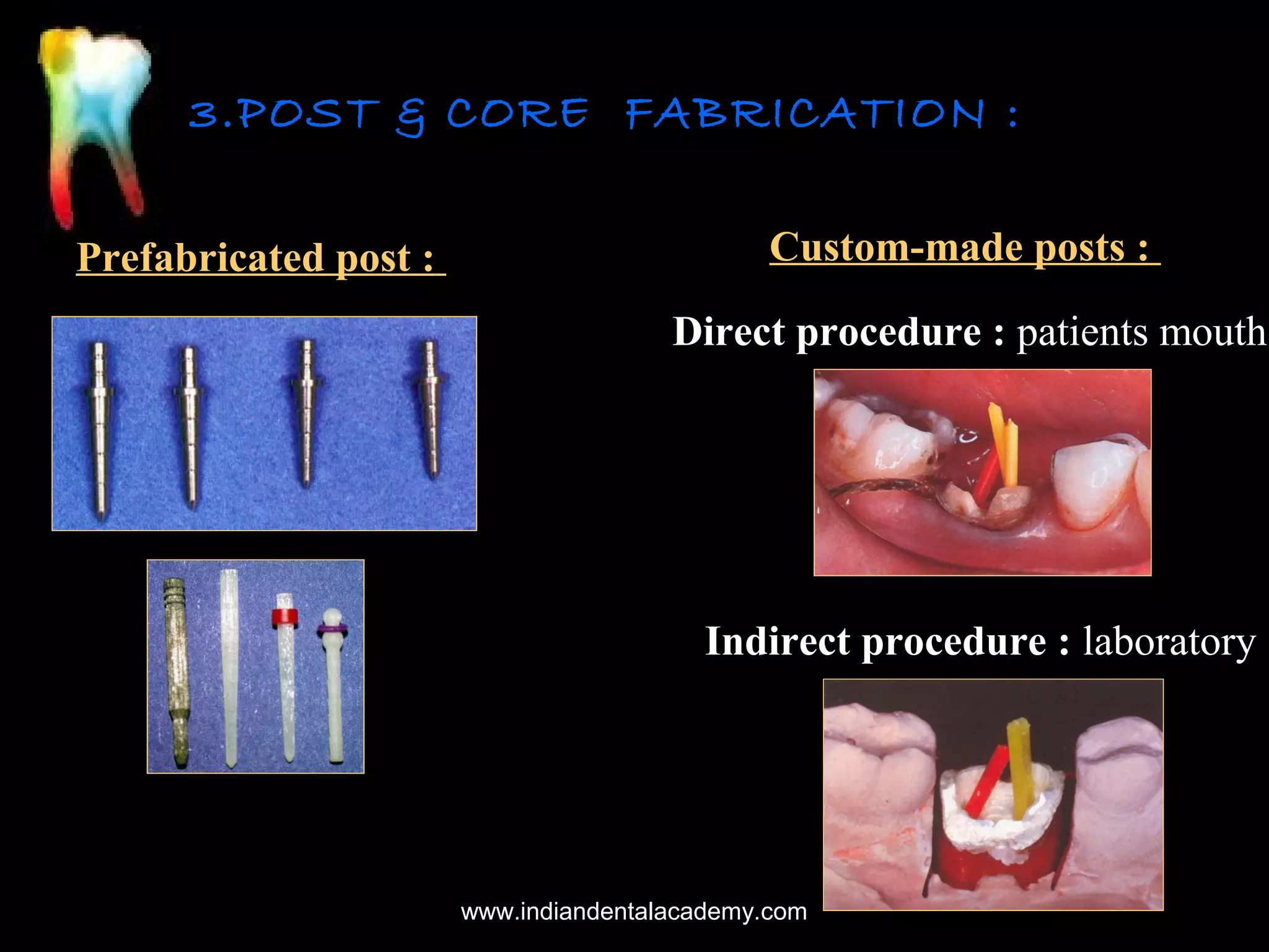 3.POST & CORE FABRICATION :
Prefabricated post :

Custom-made posts :
Direct procedure : patients mouth

Indirect procedure : laboratory

www.indiandentalacademy.com

 