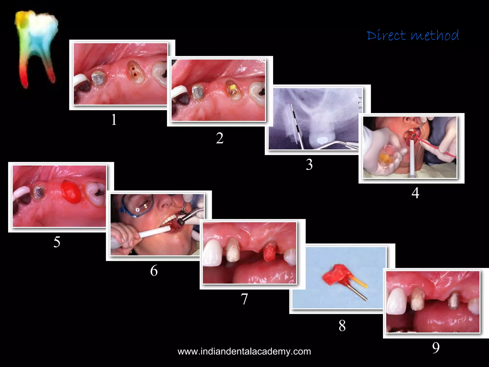 Direct method

1
2
3
4
5
6
7
8
www.indiandentalacademy.com

9

 