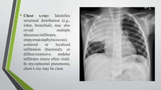 .
• Chest x-ray: Identifies
structural distribution (e.g.,
lobar, bronchial); may also
reveal multiple
abscesses/infiltrates,
empyema(staphylococcus);
scattered or localized
infiltration (bacterial); or
diffuse/extensive nodular
infiltrates (more often viral).
In mycoplasmal pneumonia,
chest x-ray may be clear.
 