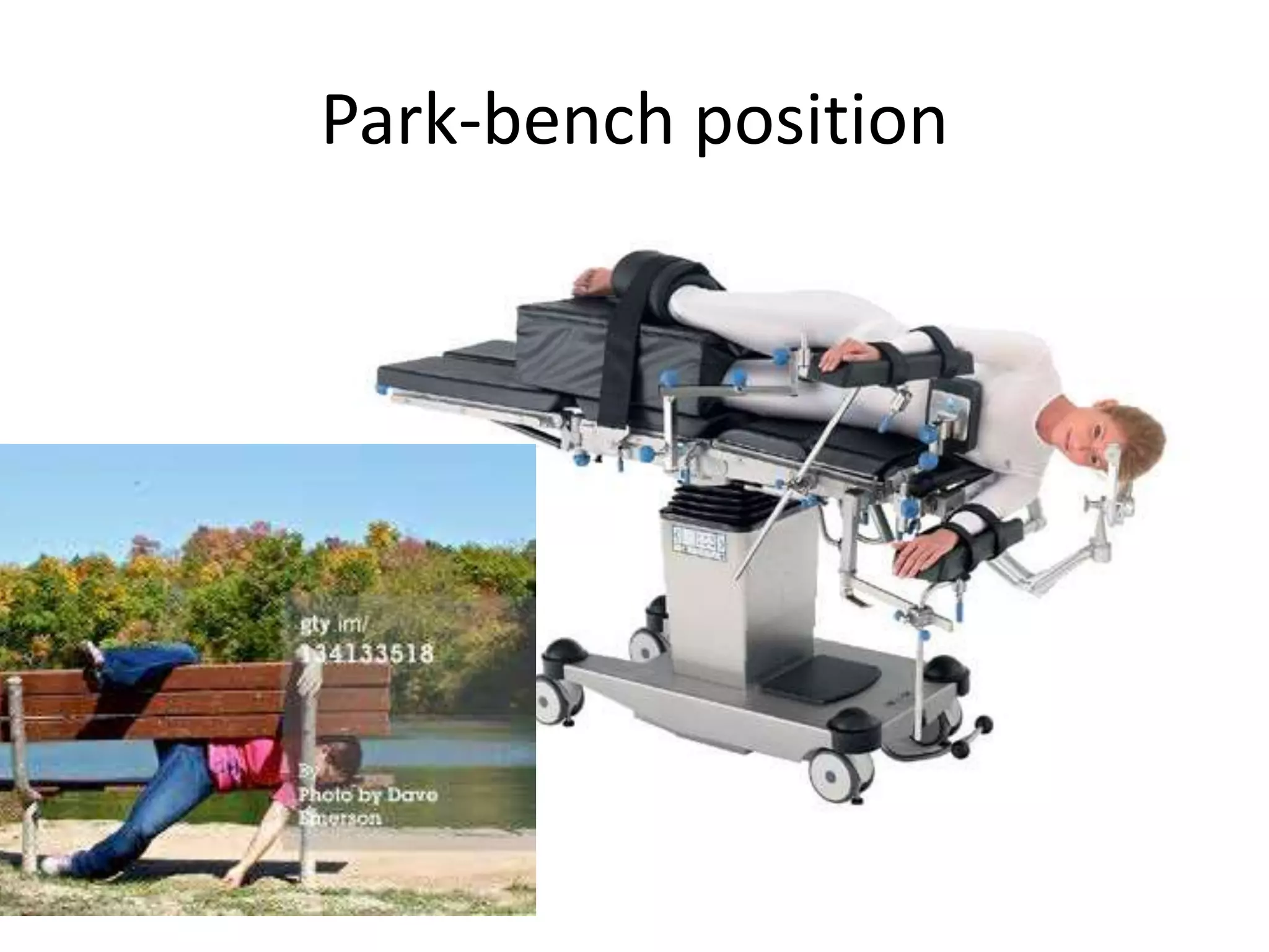 Park-bench position
 