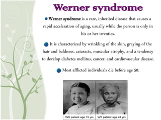 Werner syndrome is a rare, inherited disease that causes a
rapid acceleration of aging, usually while the person is only in
his or her twenties.
It is characterized by wrinkling of the skin, graying of the
hair and baldness, cataracts, muscular atrophy, and a tendency
to develop diabetes mellitus, cancer, and cardiovascular disease.
Most afflicted individuals die before age 50.
Werner syndrome
 