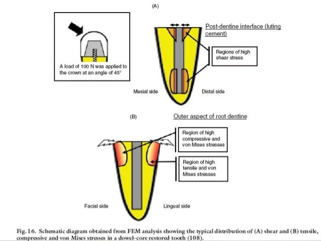 POST ENDODONTIC RESTORATION EPUB DOWNLOAD POST ENDODONTIC RESTORATION EPUB DOWNLOAD