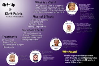 CURE (2012): Cleft Palate Infographic