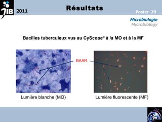 2011 Microbiologie Microbiology Poster  70 Résultats Bacilles tuberculeux vus au CyScope ®  à la MO et à la MF Lumière blanche (MO) Lumière fluorescente (MF)  BAAR 