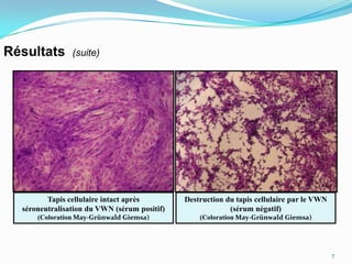 Résultats       (suite)




         Tapis cellulaire intact après        Destruction du tapis cellulaire par le VWN
  séroneutralisation du VWN (sérum positif)                (sérum négatif)
      (Coloration May-Grünwald Giemsa)            (Coloration May-Grünwald Giemsa)




                                                                                           7
 