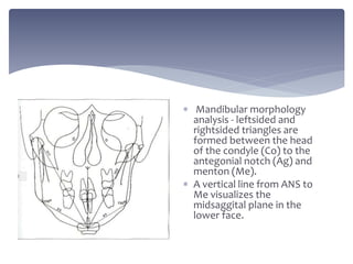  Mandibular morphology
analysis - leftsided and
rightsided triangles are
formed between the head
of the condyle (Co) to the
antegonial notch (Ag) and
menton (Me).
 A vertical line from ANS to
Me visualizes the
midsaggital plane in the
lower face.
 