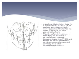  7. Maxillomandibular relation - during the
X-ray exposure, an 0.014-inch (0.356-cm)
Australian wire is placed across the
mesioocclusal areas of the maxillary first
molars, indicating the functional
posterior occlusal plane.
 The distances from the buccal cusps of
the maxillary first molar to the J-
perpendiculars are Imeasured.
 Lines connecting Ag-Ag and ANS-Me, and
the MSR line, are also drawn to reveal
dental compensations for any skeletal
asymmetry, the so-called
maxillomandibular imbalance.
 