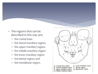  The regions that can be
described in this way are:
 the cranial base
 the lateral maxillary region;
 the upper maxillary region;
 the middle maxillary region
 the lower maxillary region
 the dental region; and
 the mandibular region.
 
