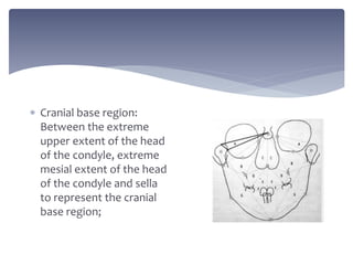  Cranial base region:
Between the extreme
upper extent of the head
of the condyle, extreme
mesial extent of the head
of the condyle and sella
to represent the cranial
base region;
 