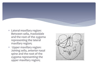  Lateral maxillary region:
Between sella, mastoidale
and the root of the zygoma
representing the lateral
maxillary region;
 Upper maxillary region:
Joining sella, anterior nasal
spine and the root of the
zygoma representing the
upper maxillary region;
 