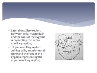  Dental region: Drawn between
upper molar points, upper
incisal point and the point of
intersection of a line joining
the...