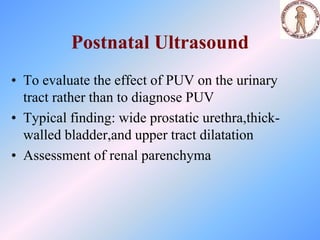 POSTERIOP URETHERAL (1).ppt