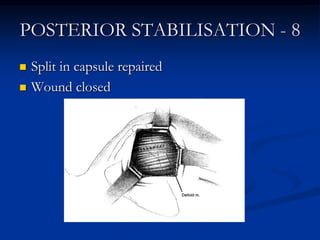 POSTERIOR STABILISATION - 8<br />Split in capsule repaired<br />Wound closed<br />